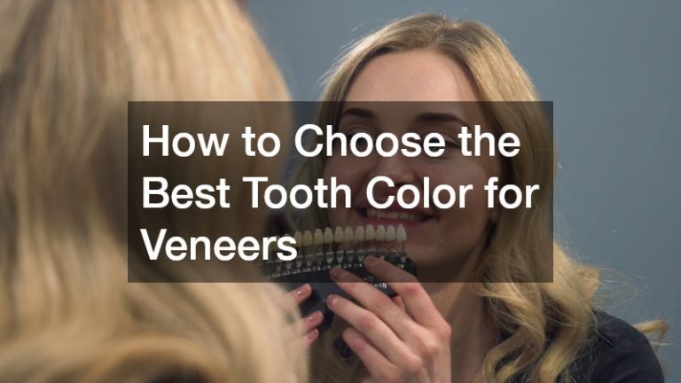 How to Choose the Best Tooth Color for Veneers