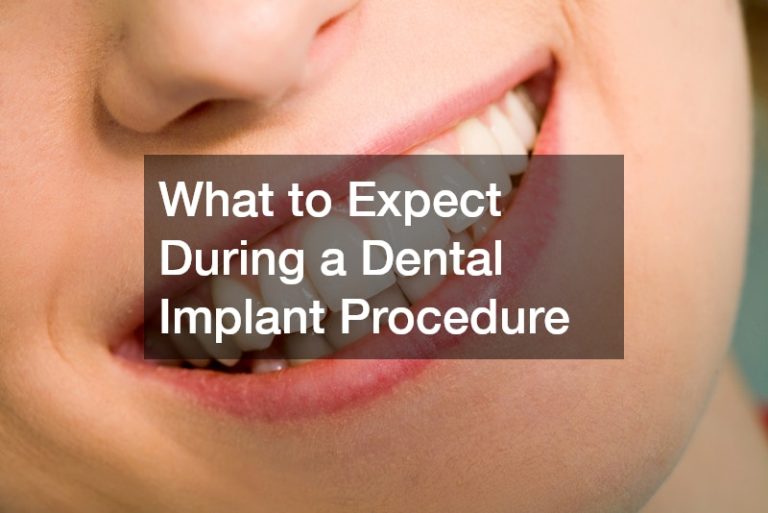 What to Expect During a Dental Implant Procedure